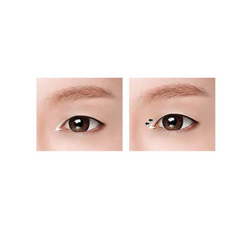 開內(nèi)眼角