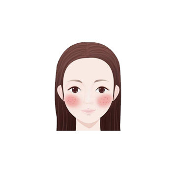 紅血絲